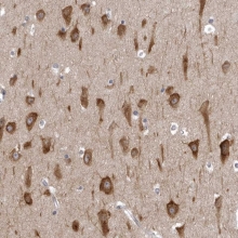 NBP1-90294 - NCEH1 / AADACL1